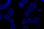 fyziologick stav chromozmu 13 v oblasti 13q12.11 vyeten sondou LSI 13q12.11(Orange) - parafnov ez