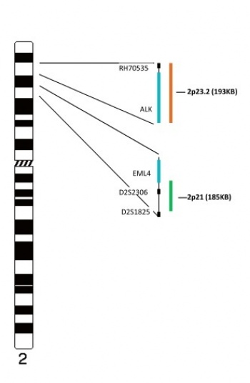 ALK-EML4