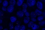 fyziologick stav chromozmu 19 v oblasti 19q13 vyeten sondou LSI 19q13 (Orange) - parafnov ez