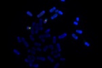 Verification of the binding region of the LSI Her-2 (Orange) / CEP17 (Green) probe with a mitotic preparation