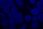Normal cell in FFPE tissue hybridized with LSI EGFR (Orange) shows 2 orange signals. 