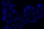 A normal cell in FFPE tissue hybridized with LSI RARA (Orange)/CEP17 (Green) shows 2 orange signals of RARA gene and 2 green signals of chromosome 17.