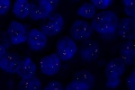 A normal cell in FFPE tissue hybridized with LSI TOP2A (Orange)/CEP17 (Green) shows 2 orange signals of TOP2A gene and 2 green signals of chromosome 17.