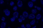 A normal cell in FFPE tissue hybridized with LSI Cyclin D1 (Orange)/CEP11 (Green) shows 2 orange signals of Cyclin D1 gene and 2 green signals of chromosome 11.