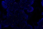 A normal cell in FFPE tissue hybridized with LSI C-MYC (Orange)/CEP8 (Green) shows 2 orange signals of C-MYC gene and 2 green signals of chromosome 8.