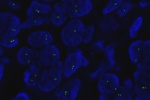2 copies of chromosome 2 in normal cell hybridized with CEP2 (Green) probe.