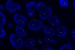 2 copies of chromosome 8 in normal cell hybridized with CEP8 (Green) probe.