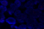 A normal cell in FFPE tissue hybridized with the LSI 17p11.2 (Orange) shows 2 orange signals of chromosome 17p11.2 region. 