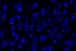 A normal cell in FFPE tissue hybridized with LSI Her-2/neu (Orange)/CEP17 (Green) shows 2 orange signals of Her-2/neu gene and 2 green signals of chromosome 17.