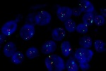 A normal cell in FFPE tissue hybridized with LSI EGFR (Orange)/CEP7 (Green) shows 2 orange signals of EGFR gene and 2 green signals of chromosome 7.