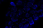 A normal cell hybridized with the LSI 10p11.1 (Orange) shows 2 orange signals of chromosome 10p11.1 region.