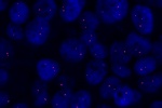 A normal cell hybridized with the LSI 19q13 (Orange) shows 2 orange signals of chromosome 19q13 region.