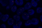 A normal cell hybridized with the LSI 1p36.3 (Orange) shows 2 orange signals of chromosome 1p36.3 region.