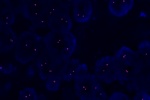 A normal cell hybridized with the LSI 9p21.3 (Orange) shows 2 orange signals of chromosome 9p21.3 region.