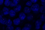 A normal cell hybridized with the LSI TOP2A (Orange) shows 2 orange signals of the TOP2A gene.