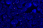 A normal cell hybridized with the LSI C-MYC (Orange) shows 2 orange signals of the C-MYC gene.