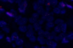 A normal cell hybridized with the LSI N-MYC (Orange) shows 2 orange signals of the N-MYC gene.