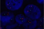 A normal cell hybridized with the LSI ALK (Orange) / LSI EML4 (Green) shows 2 orange signals (ALK) and 2 green signals (EML4).